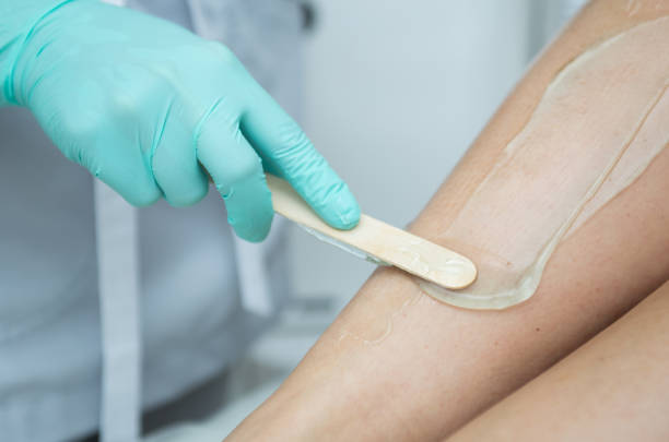 Beautician Covers The Female Leg With Gel For Laser Hair Removal Stock  Photo - Download Image Now - iStock