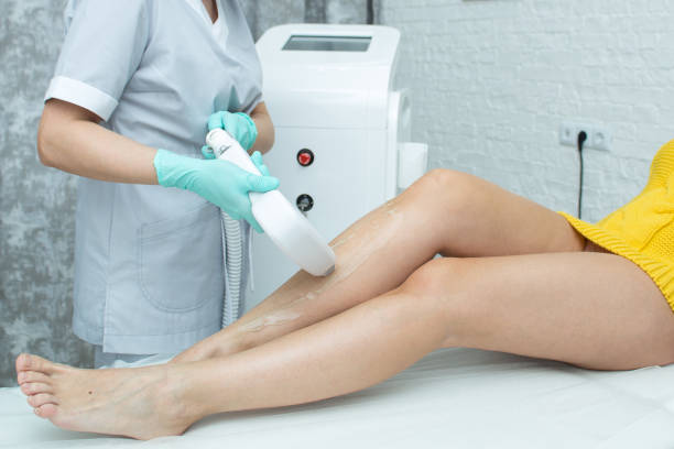 laser hair removal on the female leg. - beautician beauty treatment smooth human leg imagens e fotografias de stock
