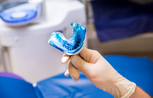 BLUE DENTAL IMPRESSION IN THE HANDS OF THE DENTIST. DENTIST'S DAY