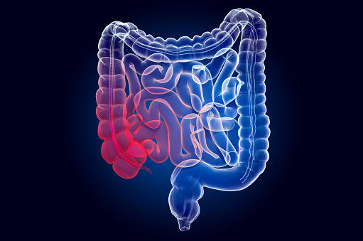 Pain in human intestines, bowel concept. Ghost light effect, x-ray hologram. 3D rendering on dark blue background