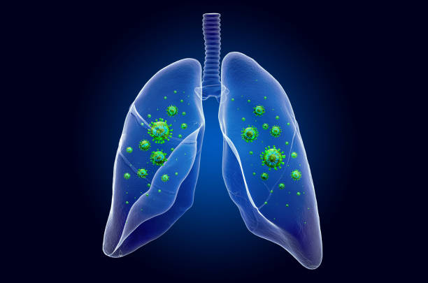 lungs with virus, ghost light effect, x-ray hologram. 3d rendering on dark blue background - bronquiolite imagens e fotografias de stock