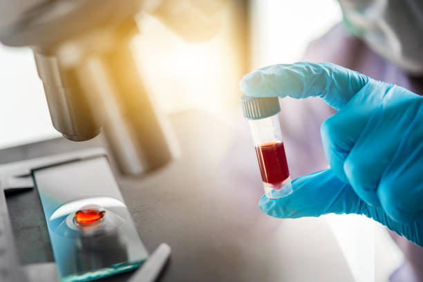 lab technician assistant analyzing a blood sample in test tube at laboratory with microscope. Medical, pharmaceutical and scientific research and development concept. stock photo