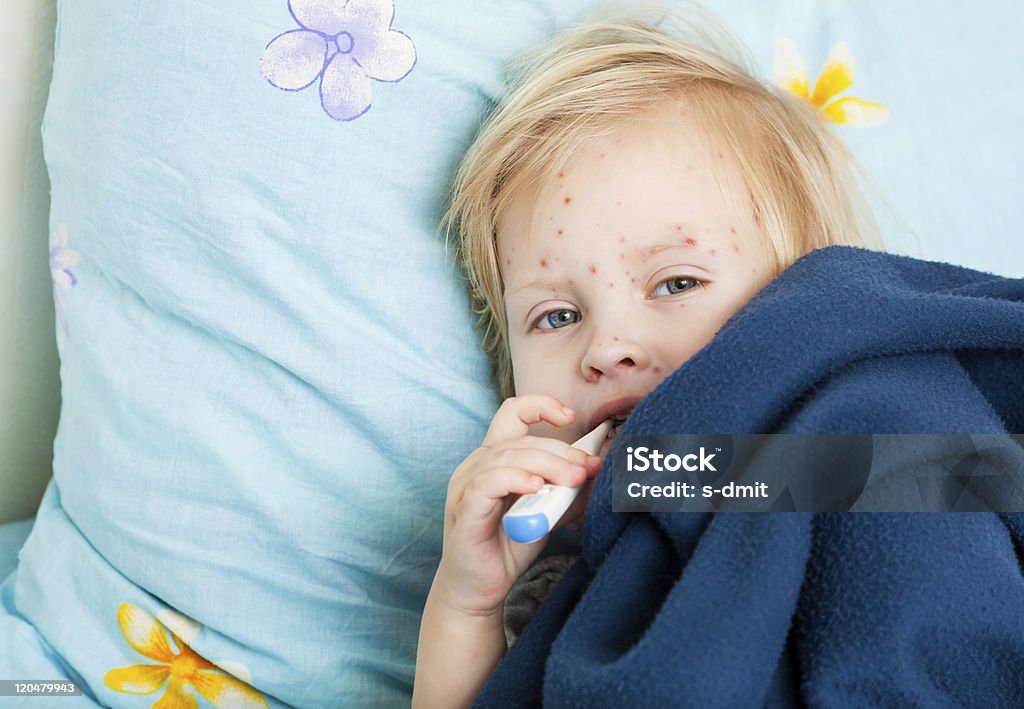 A sick girl with red spots in bed with a thermometer  a sick cute girl is measuring the temperature Chickenpox Stock Photo