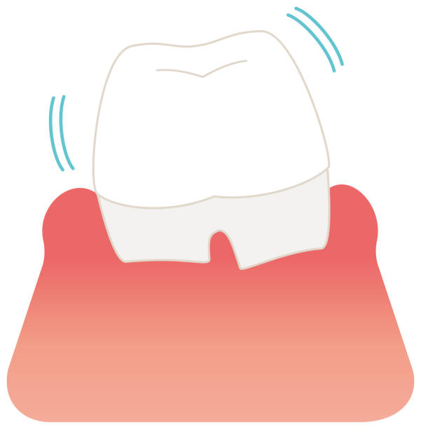 szmata bolesny ząb ilustracja wektor - human teeth gums dental hygiene inflammation stock illustrations