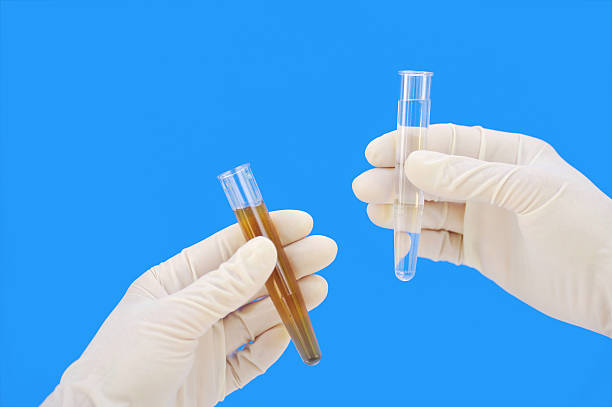 Clean and dirty water samples in hands stock photo