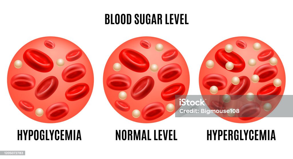 Gda Normal Realistic Detailed 3d Glucose Blood Level Ad Poster Card Vector Stock ...