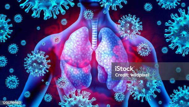 Lung Virus Infection Stock Photo - Download Image Now - Lung, Coronavirus, COVID-19