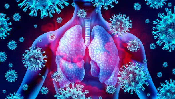Lung virus infection and coronavirus outbreak or viral pneumonia and coronaviruses influenza as a dangerous flu strain cases as a pandemic medical health risk concept with disease cells with 3D render elements.