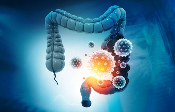 Colon cancer, bacteria, viruses in sick unhealthy intestine Colon cancer, bacteria, viruses in sick unhealthy intestine. 3d illustration rectum stock pictures, royalty-free photos & images