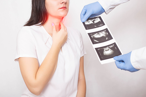 The doctor holds the results of a thyroid ultrasound examination of a girl. Thyroid diseases, nodular goiter, cancer
