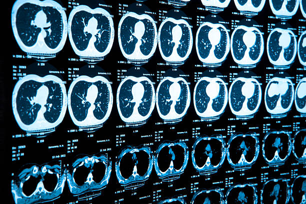 cuerpo escán médico - tomografía fotografías e imágenes de stock