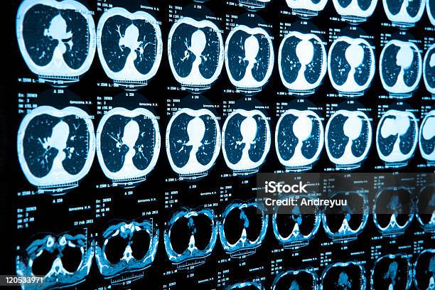 Cuerpo Escán Médico Foto de stock y más banco de imágenes de Tomografía axial computerizada - Tomografía axial computerizada, Escáner TC, Escán médico