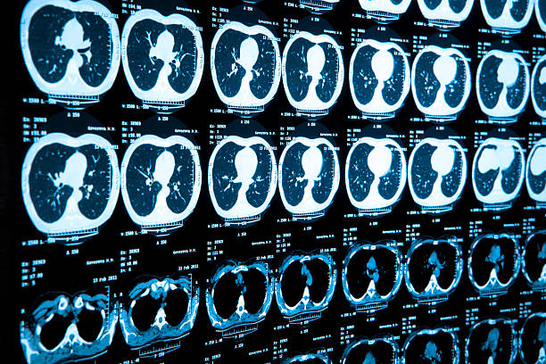 Wall of side by side body medical scan results Body medical scan cat scan stock pictures, royalty-free photos & images