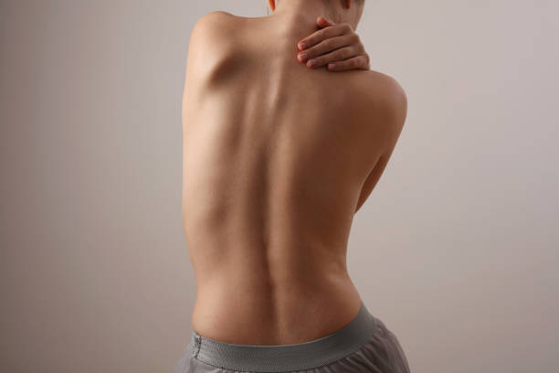 Woman with back pain, Scoliosis spine curve. Female body parts aesthetic, asymmetry stock photo