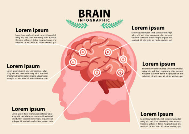 Scientific Medical Illustration Of Human Brain Stroke Illustration Stock  Illustration - Download Image Now - iStock