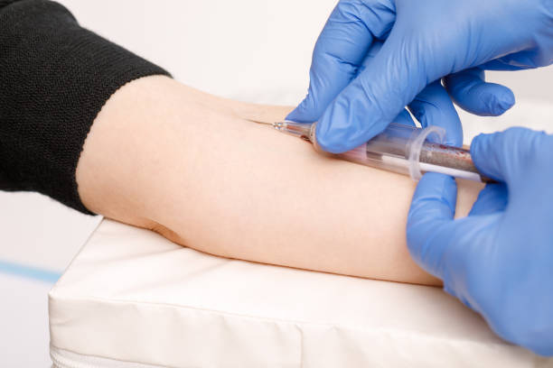 istock Nurse takes a blood sample from arm vein performing a venipuncture 1205486966