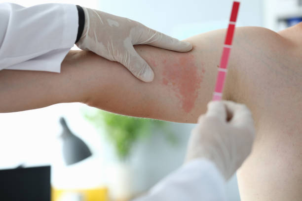 istock Doctor in protective gloves 1205529533