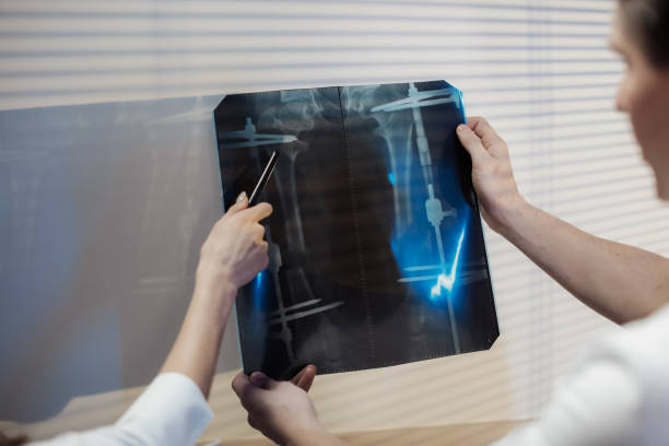 Two doctors examine the x-ray picture. Doctor the girl and the man discuss the diagnosis. stock photo