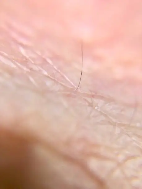 Macro of human skin closeup