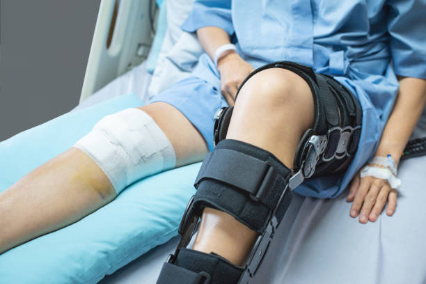 asian woman patient with bandage compression knee brace support injury on the bed in nursing hospital - orthopedics imagens e fotografias de stock