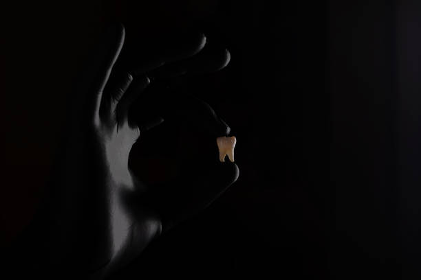 Tooth of a man in a black glove of a doctor