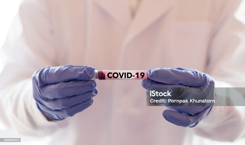 COVID-19は、新しいコロナウイルスNCPコンセプトのためにWHOによって命名されました。中国湖北省武漢市で、新しいコロナウイルスN.C.P.で血液サンプルを保持する医師またはラボ技術者、医療� - COVID-19のロイヤリティフリーストックフォト