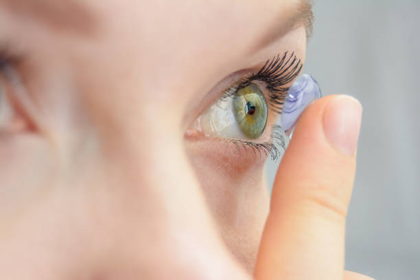 the girl holds on her finger and puts on a soft contact lens for one-day or planned replacement, the problem of myopia, poor vision, eye care stock photo