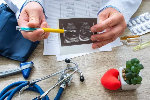 Photo of Ultrasound examination in cardiology concept photo. Doctor during consultation held in his hand and show to patient printout picture of ultrasound examination with heart pathology of pericarditis