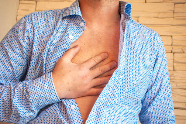 Man unbuttoned his shirt on his chest and placed his hand on sternum area because of severe pain behind his sternum or chest. Concept photo of symptom of heart pain, heartburn, myocardial infarction Man unbuttoned his shirt on his chest and placed his hand on sternum area because of severe pain behind his sternum or chest. Concept photo of symptom of heart pain, heartburn, myocardial infarction pericarditis stock pictures, royalty-free photos & images