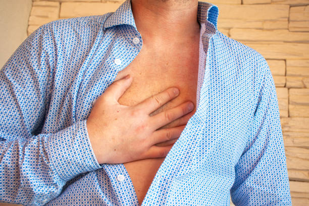 man unbuttoned his shirt on his chest and placed his hand on sternum area because of severe pain behind his sternum or chest. concept photo of symptom of heart pain, heartburn, myocardial infarction - bronquiolite imagens e fotografias de stock