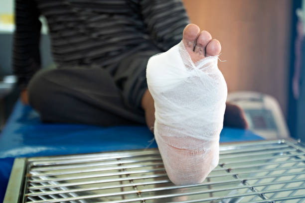 wound of diabetic foot wound of diabetic foot infected wound stock pictures, royalty-free photos & images