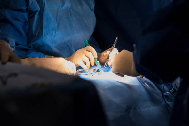 Careful surgeons in operating room Unrecognizable surgeons perform surgical procedure. surgical light stock pictures, royalty-free photos & images