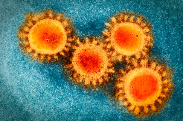 Coronavirus COVID-19 Colored visualisation of electron microscopy photo of the coronavirus  COVID-19 severe acute respiratory syndrome stock pictures, royalty-free photos & images