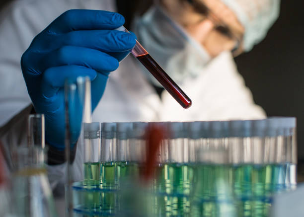 Researcher looking on blood sample in test tube. Researcher looking on blood sample in test tube. Focus on test tube. east slavs stock pictures, royalty-free photos & images