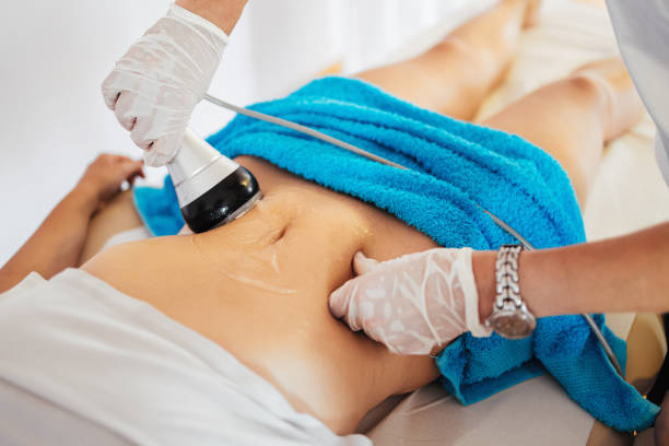 Beauty and health treatment technology Vacuum bipolar and multipolar cavitation. Modern technology treatment for health body and beauty improvement for enhancing skin elasticity and fat elimination. drainage photos stock pictures, royalty-free photos & images