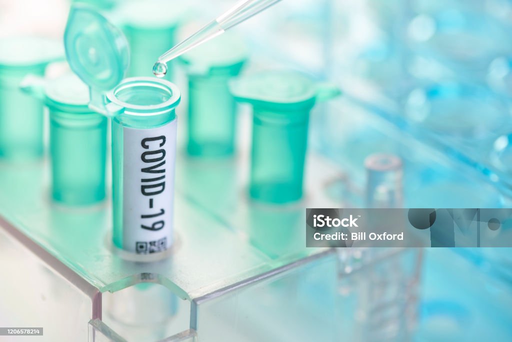 Coronavirus: flacon met pipet in laboratorium - Royalty-free Coronavirus Stockfoto