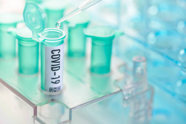 Corona virus: vial with pipette in laboratory