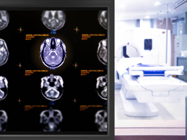 istock MRI Brain sagittal plane  on the monitor 1206582121