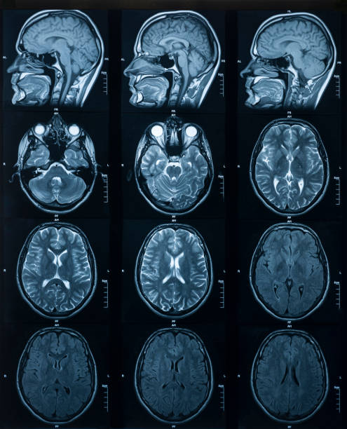 mri scan av hjärnan. medicin och hälsa - brain scan' bildbanksfoton och bilder
