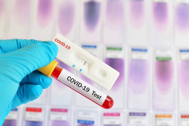 Cassette rapid test for COVID-19 Cassette rapid test for COVID-19 or novel coronavirus 2019 found in Wuhan, China middle east respiratory syndrome stock pictures, royalty-free photos & images