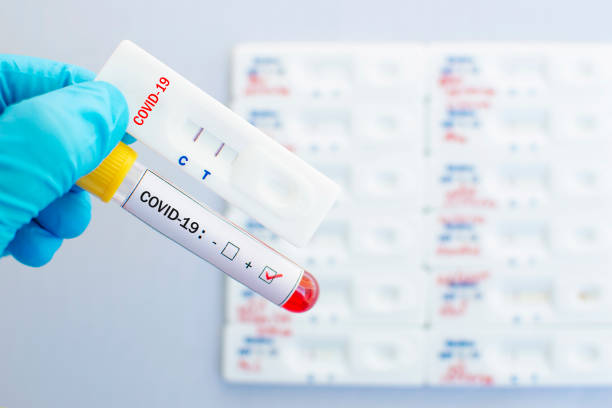 Cassette rapid test for COVID-19 Cassette rapid test for COVID-19 or novel coronavirus 2019 found in Wuhan, China biological process stock pictures, royalty-free photos & images