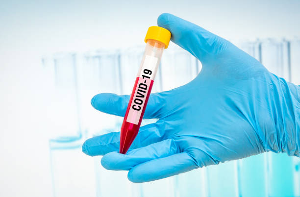 istock Scientist is holding test-tube on CORONAVIRUS COVID-19 1206710728