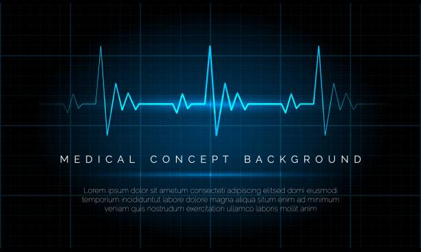 illustrazioni stock, clip art, cartoni animati e icone di tendenza di monitoraggio dell'ecg di emergenza - elettrocardiogramma