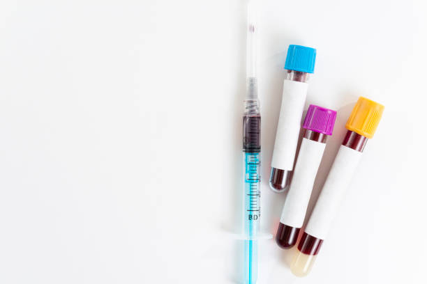 istock Test tubes with blood isolated and syringe on white. Top view 1206750879