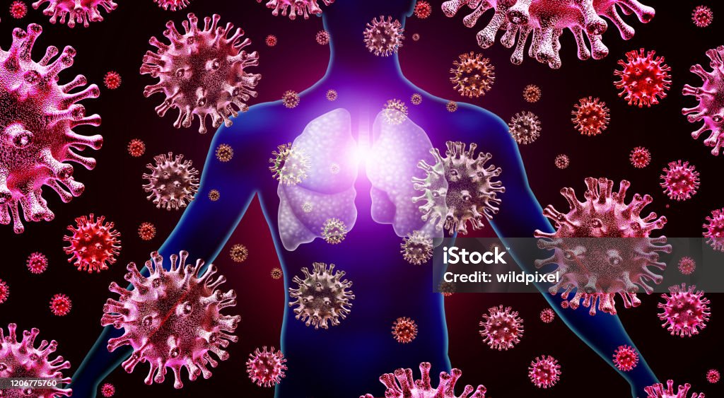 Lung Infection Respiratory virus lung infection and influenza flu outbreak and coronavirus or coronaviruses as dangerous cases of SARS as a pandemic  or epidemic medical concept with 3D illustration elements. Lung Stock Photo