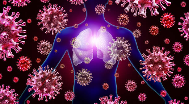 Lung Infection Respiratory virus lung infection and influenza flu outbreak and coronavirus or coronaviruses as dangerous cases of SARS as a pandemic  or epidemic medical concept with 3D illustration elements. antibiotic resistant photos stock pictures, royalty-free photos & images