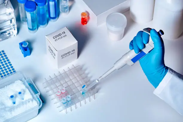 Photo of Novel coronavirus 2019 nCoV pcr diagnostics kit. This is RT-PCR kit to detect presence of 2019-nCoV or covid19 virus in clinical specimens. In vitro diagnostic test based on real-time PCR technology