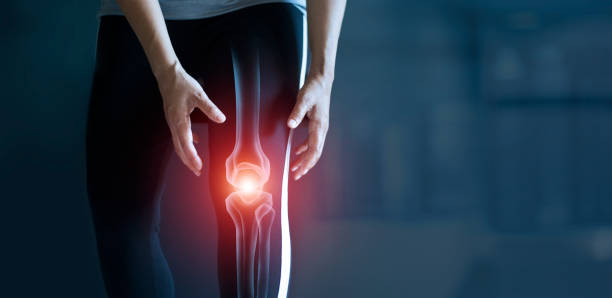 膝の痛み、運動や変形性関節症による怪我、腱の問題、暗い背景の関節炎症に苦しむ女性。 - pain joint human hand arthritis ストックフォトと画像