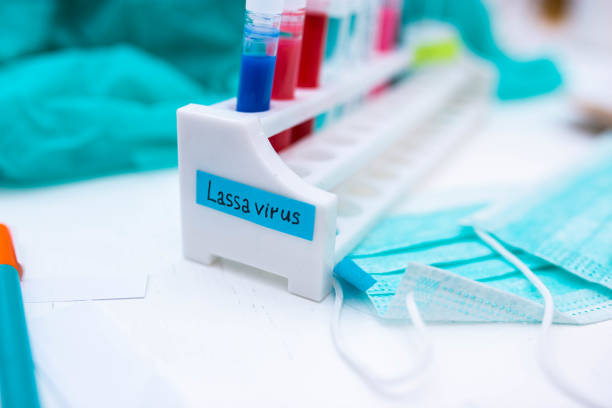 istock test Lassa fever in vitro in a laboratory. 1206927713