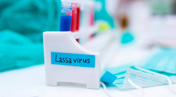 istock test Lassa fever in vitro in a laboratory. 1206927725